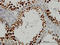 SURP And G-Patch Domain Containing 2 antibody, LS-C133627, Lifespan Biosciences, Immunohistochemistry paraffin image 