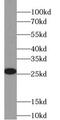 Ubiquitin C-Terminal Hydrolase L1 antibody, FNab09217, FineTest, Western Blot image 