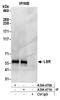 Lipolysis-stimulated lipoprotein receptor antibody, A304-470A, Bethyl Labs, Immunoprecipitation image 