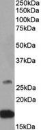 Ciliary Neurotrophic Factor antibody, TA311132, Origene, Western Blot image 