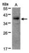 RAD51-associated protein 1 antibody, orb89983, Biorbyt, Western Blot image 