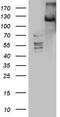 Serine/threonine-protein kinase LATS2 antibody, TA804435S, Origene, Western Blot image 