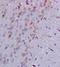 SMAD Family Member 3 antibody, orb6982, Biorbyt, Immunohistochemistry paraffin image 
