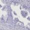 Ankyrin repeat domain-containing protein 2 antibody, PA5-59320, Invitrogen Antibodies, Immunohistochemistry frozen image 