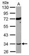 Septin-12 antibody, NBP2-20300, Novus Biologicals, Western Blot image 