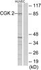 cGMP-dependent protein kinase 2 antibody, LS-C119012, Lifespan Biosciences, Western Blot image 