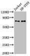 Ribonucleoprotein, PTB Binding 2 antibody, CSB-PA872547LA01HU, Cusabio, Western Blot image 