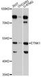 Ethanolamine kinase 1 antibody, LS-C748286, Lifespan Biosciences, Western Blot image 