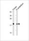 Visinin Like 1 antibody, M06959-4, Boster Biological Technology, Western Blot image 