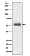 Protein TFG antibody, M02870, Boster Biological Technology, Western Blot image 