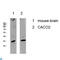 Cyclin-C antibody, LS-C813393, Lifespan Biosciences, Western Blot image 