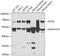 Alpha-globin transcription factor CP2 antibody, GTX16434, GeneTex, Western Blot image 