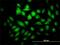 Pyrroline-5-Carboxylate Reductase 3 antibody, H00065263-M01, Novus Biologicals, Immunofluorescence image 
