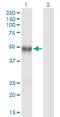 Immunoglobulin Heavy Constant Gamma 4 (G4m Marker) antibody, H00003503-B01P, Novus Biologicals, Western Blot image 
