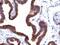 Epithelial Cell Adhesion Molecule antibody, NBP2-48265, Novus Biologicals, Immunohistochemistry paraffin image 