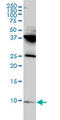 Ribosomal Protein L39 Like antibody, LS-B4546, Lifespan Biosciences, Western Blot image 