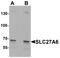 Long-chain fatty acid transport protein 6 antibody, A12118, Boster Biological Technology, Western Blot image 
