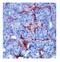 Matrix metalloproteinase-9 antibody, ARP33090_T100, Aviva Systems Biology, Immunohistochemistry frozen image 