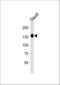Ubiquitin Specific Peptidase 25 antibody, M06182, Boster Biological Technology, Western Blot image 