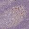 Protein Tyrosine Phosphatase Receptor Type J antibody, HPA006026, Atlas Antibodies, Immunohistochemistry frozen image 