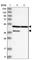 Inositol Polyphosphate-5-Phosphatase K antibody, HPA031044, Atlas Antibodies, Western Blot image 