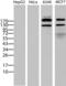 ERBB2 antibody, LS-C796707, Lifespan Biosciences, Western Blot image 