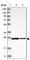 TBC1 Domain Family Member 25 antibody, HPA029197, Atlas Antibodies, Western Blot image 