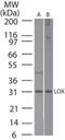 Lysyl Oxidase antibody, NBP2-24877, Novus Biologicals, Western Blot image 