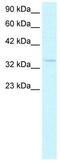 Hes Related Family BHLH Transcription Factor With YRPW Motif 1 antibody, GTX42614, GeneTex, Western Blot image 