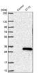 Serine/Threonine/Tyrosine Interacting Protein antibody, NBP1-92457, Novus Biologicals, Western Blot image 