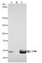 LYN Proto-Oncogene, Src Family Tyrosine Kinase antibody, GTX111584, GeneTex, Immunoprecipitation image 