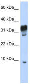 Peroxisomal Testis Enriched Protein 1 antibody, TA330930, Origene, Western Blot image 