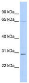 Proto-oncogene c-Rel antibody, TA335801, Origene, Western Blot image 