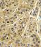 MHC Class I Polypeptide-Related Sequence A antibody, PA5-35346, Invitrogen Antibodies, Immunohistochemistry paraffin image 