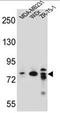 Rho GTPase-activating protein 22 antibody, AP50235PU-N, Origene, Western Blot image 