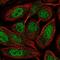 Zinc Finger Protein 630 antibody, HPA068130, Atlas Antibodies, Immunofluorescence image 