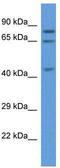 Acyl-CoA Oxidase 3, Pristanoyl antibody, TA343059, Origene, Western Blot image 