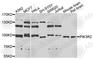 Phosphoinositide-3-Kinase Regulatory Subunit 2 antibody, A5241, ABclonal Technology, Western Blot image 