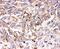 SMAD Family Member 1 antibody, PA2114, Boster Biological Technology, Immunohistochemistry paraffin image 