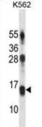 Lymphocyte Antigen 86 antibody, abx028333, Abbexa, Western Blot image 