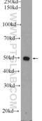 Proteasome 26S Subunit, Non-ATPase 5 antibody, 11469-1-AP, Proteintech Group, Western Blot image 