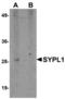 Synaptophysin Like 1 antibody, MBS151436, MyBioSource, Western Blot image 