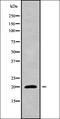 Nucleolar Pre-RRNA Processing Protein NIP7 antibody, orb337934, Biorbyt, Western Blot image 
