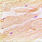 RRAD antibody, LS-C352807, Lifespan Biosciences, Immunohistochemistry paraffin image 