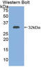Adenylate Cyclase 7 antibody, LS-B13338, Lifespan Biosciences, Western Blot image 