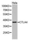 Cytotoxic T-Lymphocyte Associated Protein 4 antibody, LS-C193047, Lifespan Biosciences, Western Blot image 