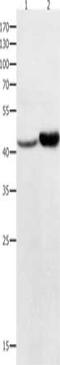 NFKB Inhibitor Delta antibody, CSB-PA173796, Cusabio, Western Blot image 