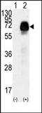 Anti-Mullerian Hormone Receptor Type 2 antibody, AP13726PU-N, Origene, Western Blot image 