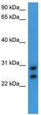 Carcinoembryonic Antigen Related Cell Adhesion Molecule 7 antibody, TA342851, Origene, Western Blot image 