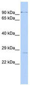 Potassium Channel Tetramerization Domain Containing 15 antibody, TA338710, Origene, Western Blot image 